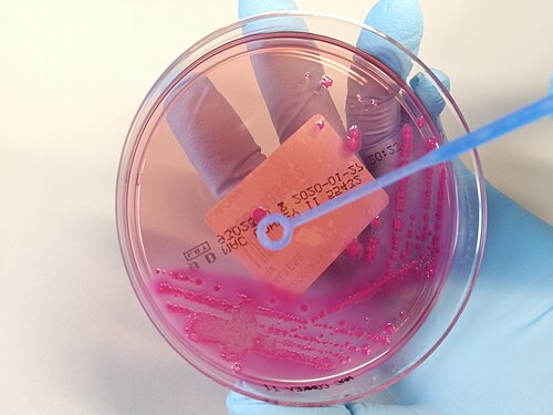 Photo of Petri dish